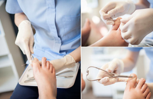 Dr. Gary M. Deresh
Cirugía ambulatoria para:
• Juanetes
• Dedos deformes
• Corrección permanente de uñeros
• Espuelones
• Fascitis plantar
• Callosidades
• Lesiones en la piel