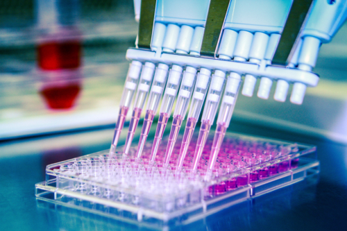                                                                                             • Servicios Especializados

•Análisis de Semen

• La mayoría de los laboratorios procesan las muestras de semen manualmente.  En nuestras facilidades contamos con la Lcda. Lina García certificada por el “Center for Reproductive Medicine” del Cleveland Clinic en Ohio. La Lcda. analiza las muestras y ofrece resultados exactos y precisos combinando la técnica manual con los adelantos tecnológicos de nuestro equipo especializado SQA-V. 

• Reportamos diferentes parámetros como los espermatozoides funcionales y su velocidad los cuales no se pueden reportar  por métodos manuales.  Además, preparamos las muestras de semen para procesos de inseminación. 

• Pruebas de ADN

• Ofrecemos todo tipo de pruebas de ADN, Paternidad, Hermanos y Abuelos. 

• Procesamos también, perfiles genéticos y detección de ADN en textiles. 

• Las pruebas de paternidad  pueden ser privativas o legales las cuales son admisibles en corte.  Los resultados estarán listos en 72 horas luego de que se comience a procesar la muestra.

• Pruebas de Plomo 

• La ley Num. 39 del 30 de marzo de 2011 establece que  los niños entre las edades de 6 meses a 6 años de edad  presenten  el resultado de su prueba de plomo al comenzar el año escolar.  Es por eso que en nuestras facilidades, contamos  con el  equipo  necesario para procesar  dicha prueba y ofrecer los resultados en 24 horas o menos sin necesidad de enviarlas a un laboratorio de referencia.

• Pruebas de H. Pylori en aliento
• Pruebas de antiaging
• Pruebas prenatales
• Prueba Harmony 
• Es un nuevo tipo de prueba que analiza el ADN en la sangre para predecir el riesgo de varias afecciones genéticas como el Síndrome de Down, Síndrome de Edwars (trisomía 18) y Síndrome de Patau (trisomía 13). Detecta el 99% de los casos de la Trisomía 21 o Síndrome de Down y su tasa de falsos positivos es menor del 0.1%.  Esta prueba puede realizarse entre las 10 y 40 semanas de gestación. 

• Además ofrecemos otros tipos de pruebas que se utilizan para detectar las afecciones genéticas como el: 
Serum Integrated
Afp4
Afp Plus
MAfp

• Pruebas de Micronutrientes

• Las deficiencias de vitaminas, minerales y antioxidantes han demostrado suprimir la función del sistema inmune, que puede contribuir a los procesos degenerativos como la artritis, cáncer, enfermedades cardiovasculares y diabetes.  La Prueba de Micronutrientes mide la función de ciertas vitaminas, minerales, antioxidantes y otros micronutrientes esenciales dentro de los glóbulos blancos. Estos análisis pueden revelar el estado funcional de los nutrientes del organismo durante un periodo más largo que las pruebas convencionales de suero.
	
• Pruebas genéticas

• Procesamos pruebas genéticas para desordenes hereditarios. Nuestros exámenes incluyen análisis completos de genes usando las secuencias del DNA. Estas pruebas genéticas se utilizan para detectar diferentes predisposiciones hereditarias como condiciones cardiacas, metabólicas, inmunológicas, de cáncer, endocrinológicas, entre otras.
                                                                                    