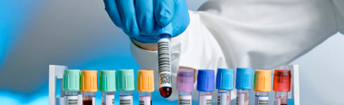                                                                                             • Prueba de influenza
• CBC
• Pruebas de embarazo
• Pruebas WIC
• Pruebas de dopaje
• Pruebas de tiroide
• Pruebas de lípido (colesterol y triglicéridos)
• Pruebas para matrimonio
• Pruebas de hemoglobina
• Servicio al hogar
• Resultados en 24 horas (pruebas de rutina)
• Resultados Electronicamente
                                                                                    