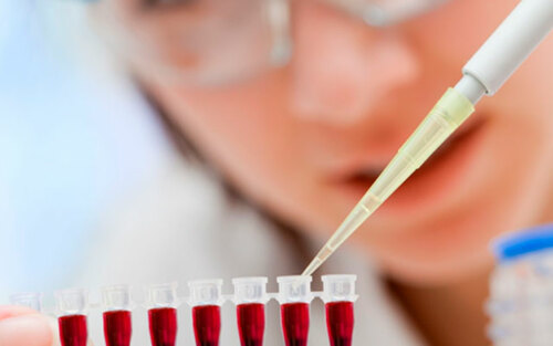                                                                                             • Prueba de influenza
• CBC
• Pruebas de embarazo
• Pruebas WIC
• Pruebas de dopaje
• Pruebas de tiroide
• Pruebas de lípido (colesterol y triglicéridos)
• Pruebas para matrimonio
• Pruebas de hemoglobina
• Servicio al hogar
• Resultados en 24 horas (pruebas de rutina)
• Resultados Electronicamente
                                                                                    