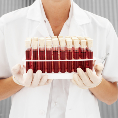 Banco de sangre
Tu Donación podría salvar alguno de tus seres querido, donar es sumamente sencillo, llámanos y te orientamos.
Somos el único banco de sangre en todo el Este de Puerto Rico. Abierto desde 1993. Servimos a todos los hospitales del área Este.