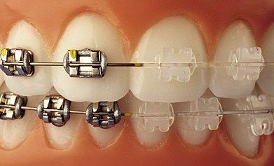 Cirujano Dentista Dra Vanessa Estrella Infopaginas