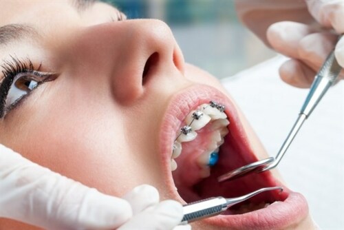                                                                                             Aceptamos todos los planes médicos incluyendo Plan Vital. Atendemos emergencias sin cita previa.
extracciones dentales 
limpieza dental 
restauraciones esteticas
blanqueamiento dental 
puentes
coronas
                                                                                    