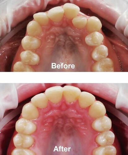 Oficina Dental Dr. Luis A. Pacheco
• Carillas dentales
• Diseño de sonrisa
• Odontologia General
• Servicios dentales en general
• Braces