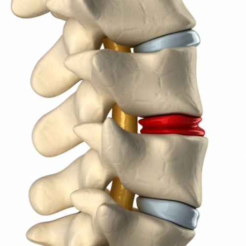 • Rayos x
• Estudios computarizados de la columna vertebral
• Fisioterapia
• Terapia láser
• Masajes
• Prevención y tratamiento columna vertebral