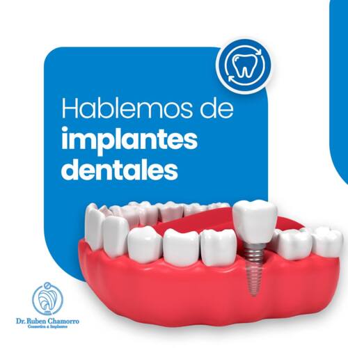                                                                                             • Implantes dentales
• Blanqueamiento profesional
• Laminados de porcelana
• Restauraciones blancas
                                                                                    