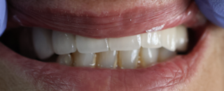 • Odontología general
• Implantes dentales
• Ortodoncia (brackets y alineadores)
• Limpiezas dentales
• Puentes fijos
• Coronas
• Reconstrucción oral