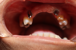 • Odontología general
• Implantes dentales
• Ortodoncia (brackets y alineadores)
• Limpiezas dentales
• Puentes fijos
• Coronas
• Reconstrucción oral