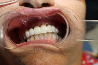 • Odontología general
• Implantes dentales
• Ortodoncia (brackets y alineadores)
• Limpiezas dentales
• Puentes fijos
• Coronas
• Reconstrucción oral