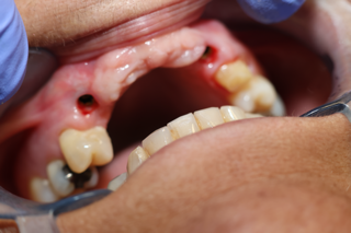 • Odontología general
• Implantes dentales
• Ortodoncia (brackets y alineadores)
• Limpiezas dentales
• Puentes fijos
• Coronas
• Reconstrucción oral