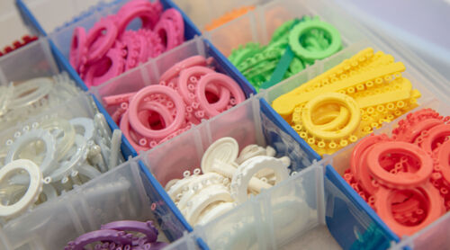                                                                                             • Invisalign
• Atendemos adultos y niños
• Braces metálicos y estéticos
• Mantenedores de espacio
• Ortodoncia Correctiva e Interceptiva
• Blanqueado
                                                                                    