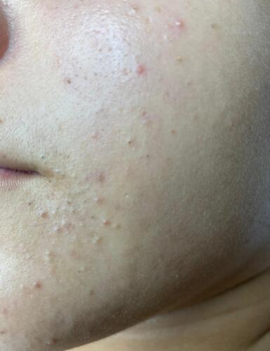 Tratamiento Facial
• Limpieza Profunda
• Facial con Hidratación
• Hidrofacial
• Facial Microdermabrasion
• Facial con Dermaplaning
Damas – Peinados
• Dependiendo el largo del cabello
• Lavado Cabello