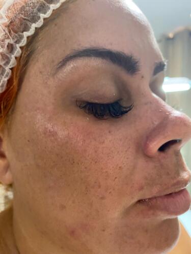 Tratamiento Facial
• Limpieza Profunda
• Facial con Hidratación
• Hidrofacial
• Facial Microdermabrasion
• Facial con Dermaplaning
Damas – Peinados
• Dependiendo el largo del cabello
• Lavado Cabello