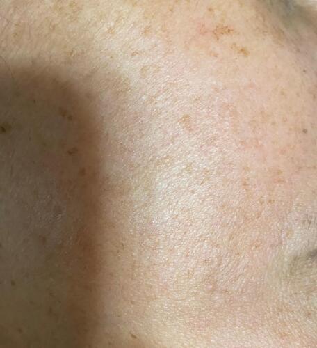 Tratamiento Facial
• Limpieza Profunda
• Facial con Hidratación
• Hidrofacial
• Facial Microdermabrasion
• Facial con Dermaplaning
Damas – Peinados
• Dependiendo el largo del cabello
• Lavado Cabello