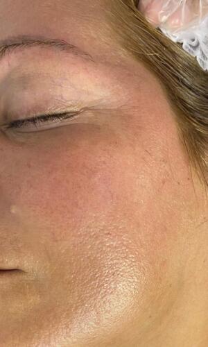 Tratamiento Facial
• Limpieza Profunda
• Facial con Hidratación
• Hidrofacial
• Facial Microdermabrasion
• Facial con Dermaplaning
Damas – Peinados
• Dependiendo el largo del cabello
• Lavado Cabello