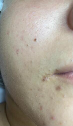 Tratamiento Facial
• Limpieza Profunda
• Facial con Hidratación
• Hidrofacial
• Facial Microdermabrasion
• Facial con Dermaplaning
Damas – Peinados
• Dependiendo el largo del cabello
• Lavado Cabello