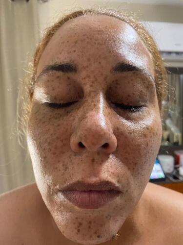 Tratamiento Facial
• Limpieza Profunda
• Facial con Hidratación
• Hidrofacial
• Facial Microdermabrasion
• Facial con Dermaplaning
Damas – Peinados
• Dependiendo el largo del cabello
• Lavado Cabello