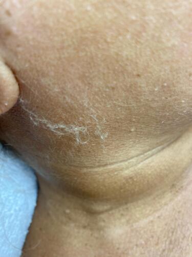 Tratamiento Facial
• Limpieza Profunda
• Facial con Hidratación
• Hidrofacial
• Facial Microdermabrasion
• Facial con Dermaplaning
Damas – Peinados
• Dependiendo el largo del cabello
• Lavado Cabello