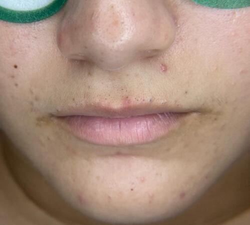                                                                                             Tratamiento Facial
• Limpieza Profunda
• Facial con Hidratación
• Hidrofacial
• Facial Microdermabrasion
• Facial con Dermaplaning

Damas – Peinados
• Dependiendo el largo del cabello
• Lavado Cabello
                                                                                    