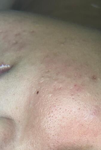                                                                                             Tratamiento Facial
• Limpieza Profunda
• Facial con Hidratación
• Hidrofacial
• Facial Microdermabrasion
• Facial con Dermaplaning

Damas – Peinados
• Dependiendo el largo del cabello
• Lavado Cabello
                                                                                    