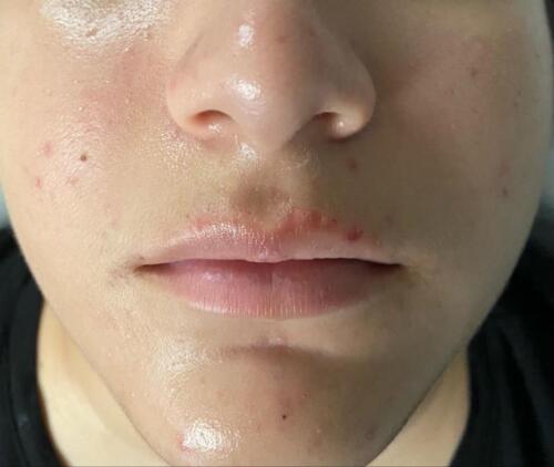                                                                                             Tratamiento Facial
• Limpieza Profunda
• Facial con Hidratación
• Hidrofacial
• Facial Microdermabrasion
• Facial con Dermaplaning

Damas – Peinados
• Dependiendo el largo del cabello
• Lavado Cabello
                                                                                    