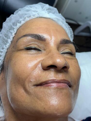                                                                                             Tratamiento Facial
• Limpieza Profunda
• Facial con Hidratación
• Hidrofacial
• Facial Microdermabrasion
• Facial con Dermaplaning

Damas – Peinados
• Dependiendo el largo del cabello
• Lavado Cabello
                                                                                    
