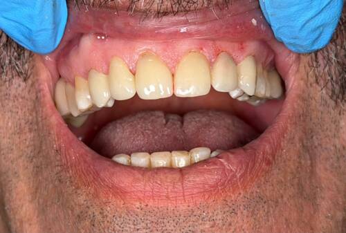• Odontología general
• Implantes dentales
• Ortodoncia (brackets y alineadores)
• Limpiezas dentales