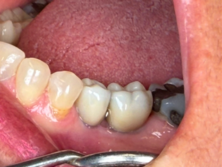 Corozal Dental(2).JPG
Corozal Dental(3).jpg
Corozal Dental(4).JPG
Corozal Dental(5).jpg
Corozal Dental(6).JPG
Corozal Dental(7).JPG
Corozal Dental(8).JPG
Corozal Dental(9).jpg
Corozal Dental(10).JPG
Corozal Dental(11).JPG
Corozal Dental(12).JPG
Corozal Dental(13).JPG
Corozal Dental(14).JPG
Healing cap.jpg
Implante.jpg