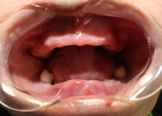 Corozal Dental(2).JPG
Corozal Dental(3).jpg
Corozal Dental(4).JPG
Corozal Dental(5).jpg
Corozal Dental(6).JPG
Corozal Dental(7).JPG
Corozal Dental(8).JPG
Corozal Dental(9).jpg
Corozal Dental(10).JPG
Corozal Dental(11).JPG
Corozal Dental(12).JPG
Corozal Dental(13).JPG
Corozal Dental(14).JPG
Healing cap.jpg
Implante.jpg