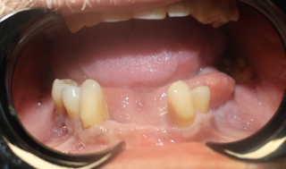 Corozal Dental(2).JPG
Corozal Dental(3).jpg
Corozal Dental(4).JPG
Corozal Dental(5).jpg
Corozal Dental(6).JPG
Corozal Dental(7).JPG
Corozal Dental(8).JPG
Corozal Dental(9).jpg
Corozal Dental(10).JPG
Corozal Dental(11).JPG
Corozal Dental(12).JPG
Corozal Dental(13).JPG
Corozal Dental(14).JPG
Healing cap.jpg
Implante.jpg