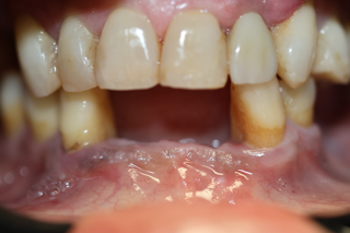 Corozal Dental(2).JPG
Corozal Dental(3).jpg
Corozal Dental(4).JPG
Corozal Dental(5).jpg
Corozal Dental(6).JPG
Corozal Dental(7).JPG
Corozal Dental(8).JPG
Corozal Dental(9).jpg
Corozal Dental(10).JPG
Corozal Dental(11).JPG
Corozal Dental(12).JPG
Corozal Dental(13).JPG
Corozal Dental(14).JPG
Healing cap.jpg
Implante.jpg