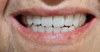 Corozal Dental(2).JPG
Corozal Dental(3).jpg
Corozal Dental(4).JPG
Corozal Dental(5).jpg
Corozal Dental(6).JPG
Corozal Dental(7).JPG
Corozal Dental(8).JPG
Corozal Dental(9).jpg
Corozal Dental(10).JPG
Corozal Dental(11).JPG
Corozal Dental(12).JPG
Corozal Dental(13).JPG
Corozal Dental(14).JPG
Healing cap.jpg
Implante.jpg