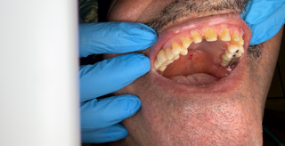Corozal Dental(2).JPG
Corozal Dental(3).jpg
Corozal Dental(4).JPG
Corozal Dental(5).jpg
Corozal Dental(6).JPG
Corozal Dental(7).JPG
Corozal Dental(8).JPG
Corozal Dental(9).jpg
Corozal Dental(10).JPG
Corozal Dental(11).JPG
Corozal Dental(12).JPG
Corozal Dental(13).JPG
Corozal Dental(14).JPG
Healing cap.jpg
Implante.jpg