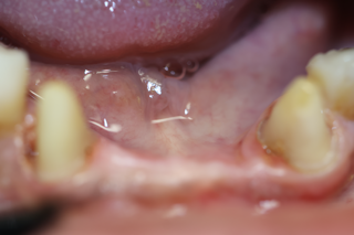 Corozal Dental(2).JPG
Corozal Dental(3).jpg
Corozal Dental(4).JPG
Corozal Dental(5).jpg
Corozal Dental(6).JPG
Corozal Dental(7).JPG
Corozal Dental(8).JPG
Corozal Dental(9).jpg
Corozal Dental(10).JPG
Corozal Dental(11).JPG
Corozal Dental(12).JPG
Corozal Dental(13).JPG
Corozal Dental(14).JPG
Healing cap.jpg
Implante.jpg